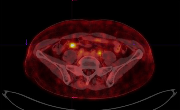 Fig. 1