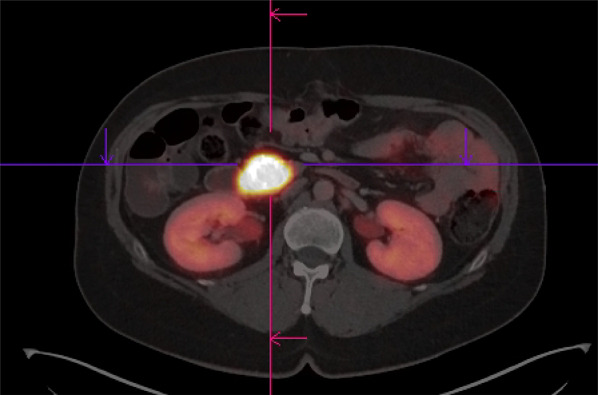 Fig. 3