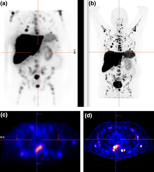 Fig. 2