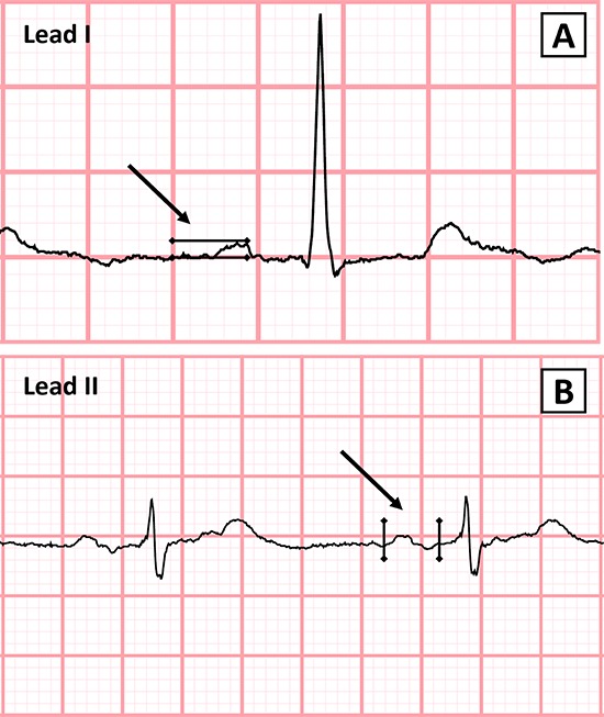 Figure 1A,1B.