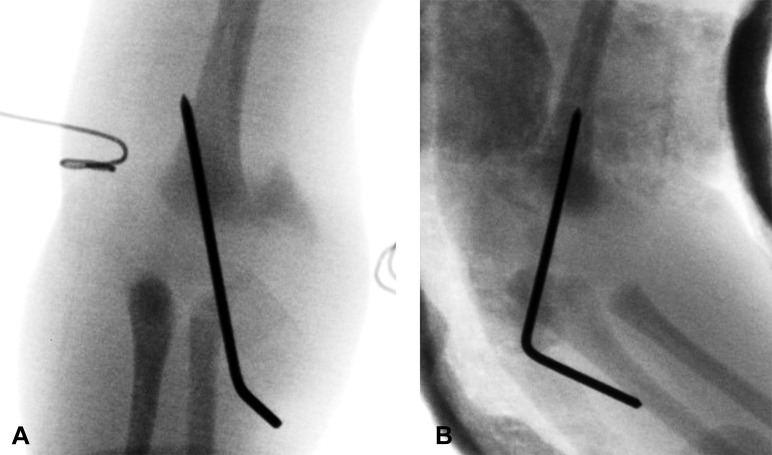 Fig. 6