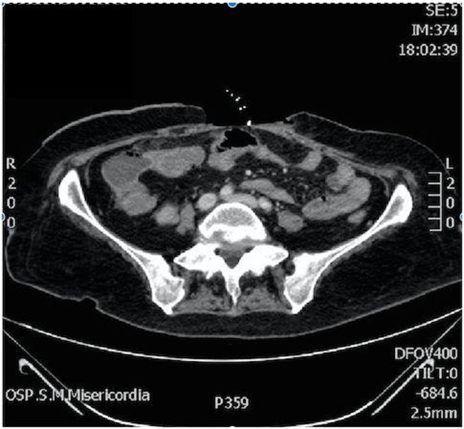 Fig. 3