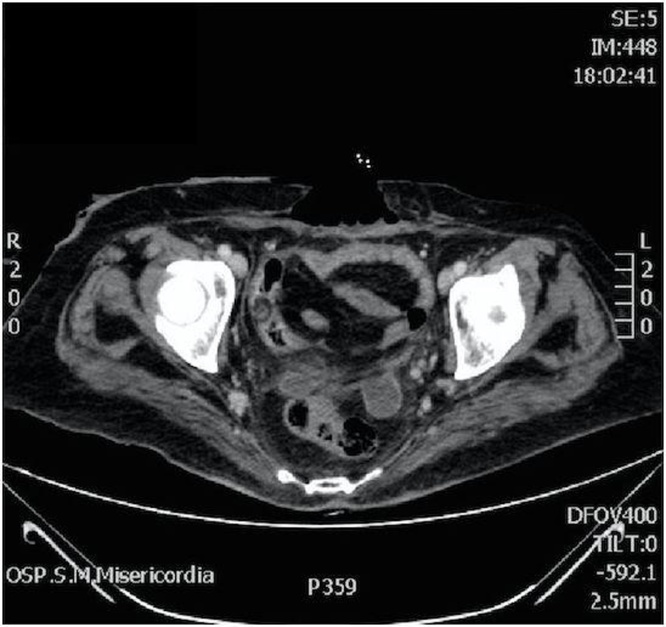 Fig. 2