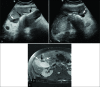 Figure 2: