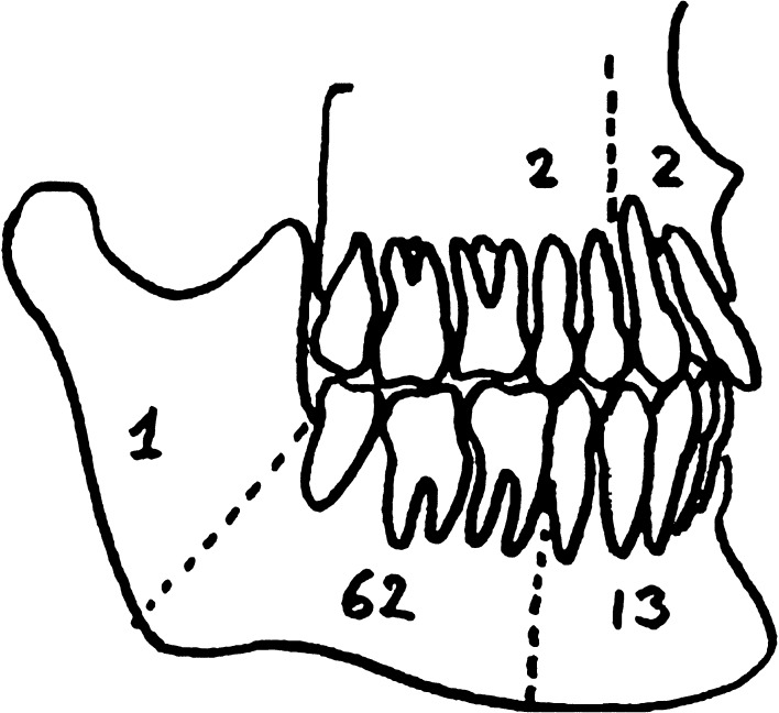 Fig. 1