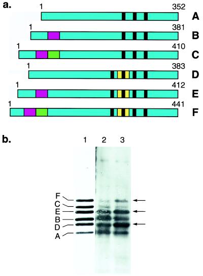 Mutation in the tau gene in familial multiple system tauopathy with ...