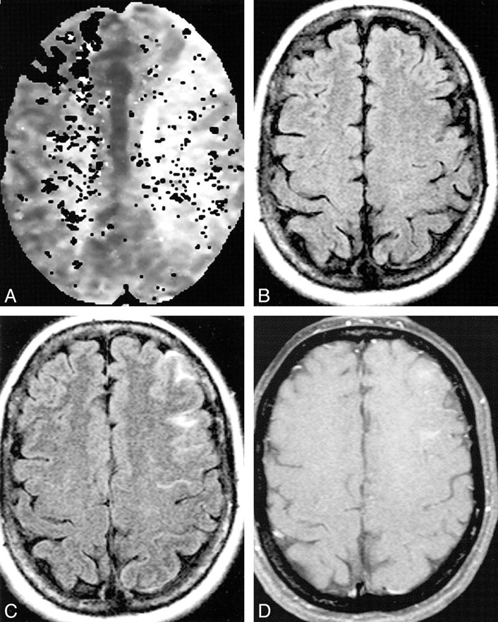 fig 1.