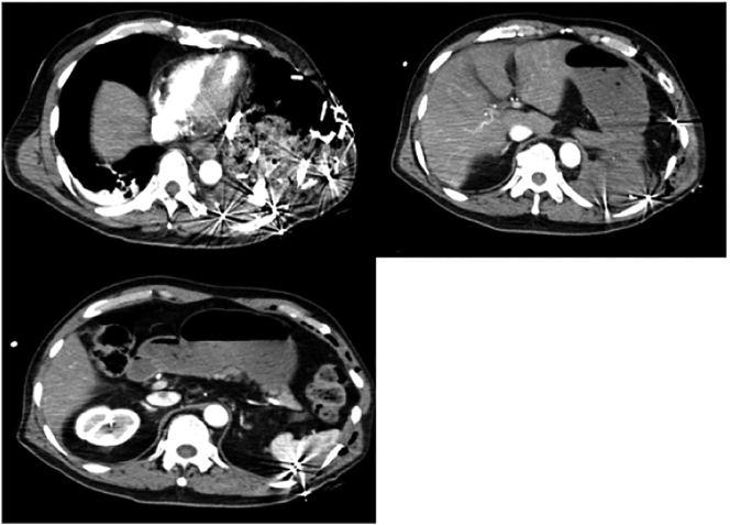 Fig. 2
