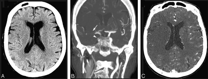 Fig 4.