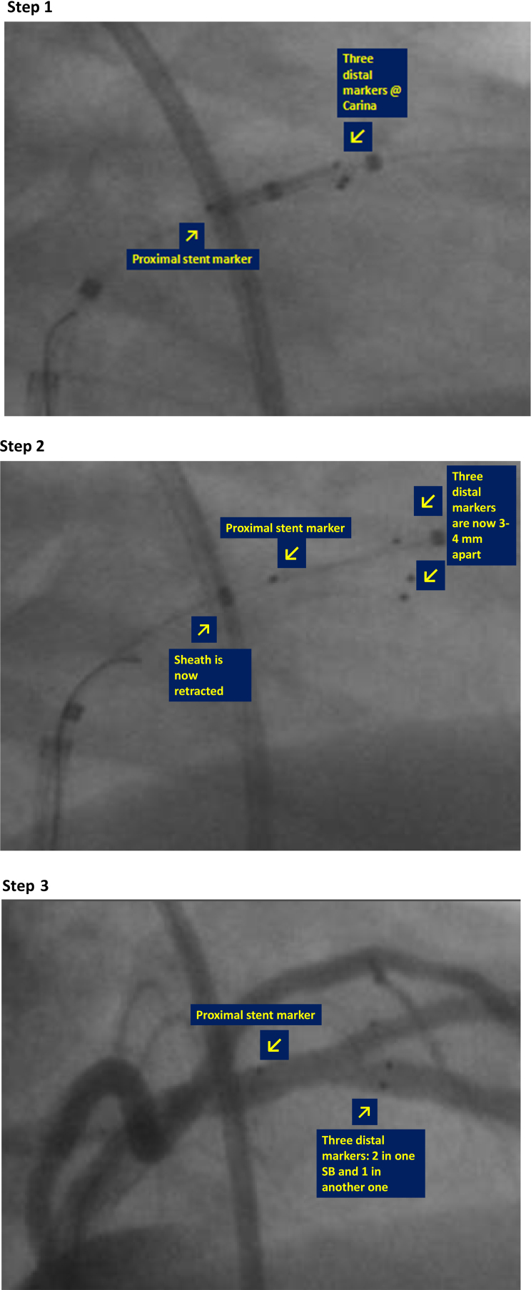 Fig. 9