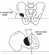 Fig. (2)