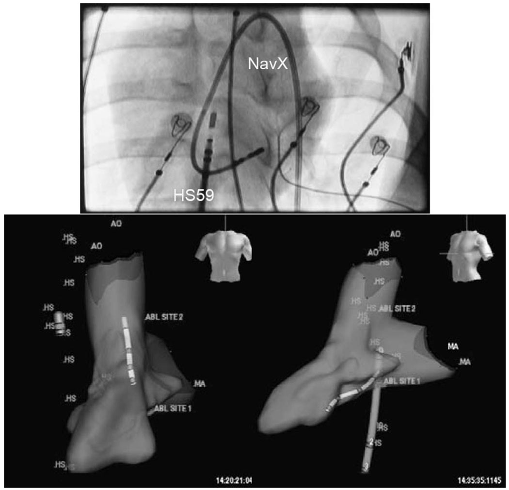 Fig. 13