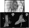 Fig. 13