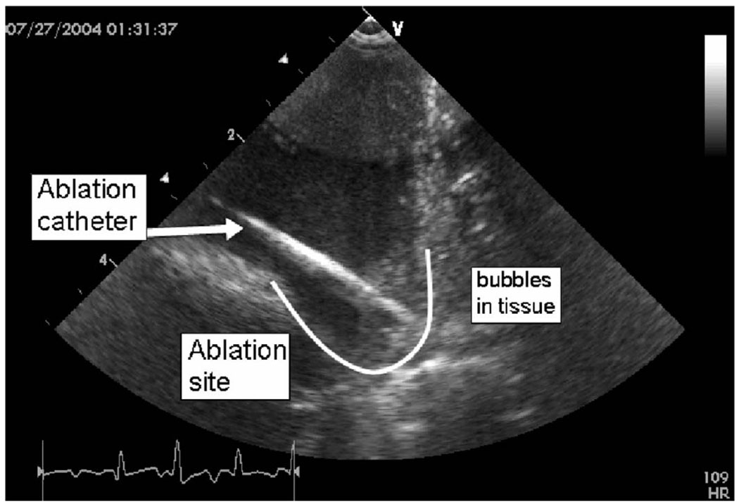 Fig. 12