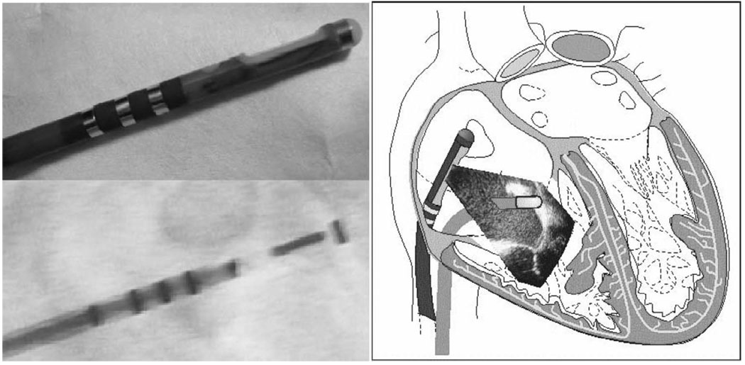 Fig. 11