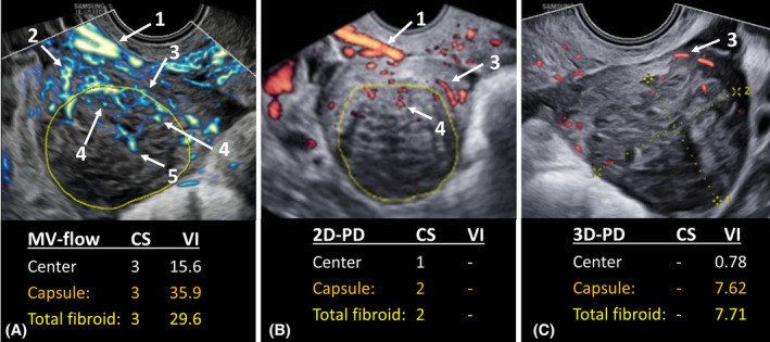 FIGURE 2