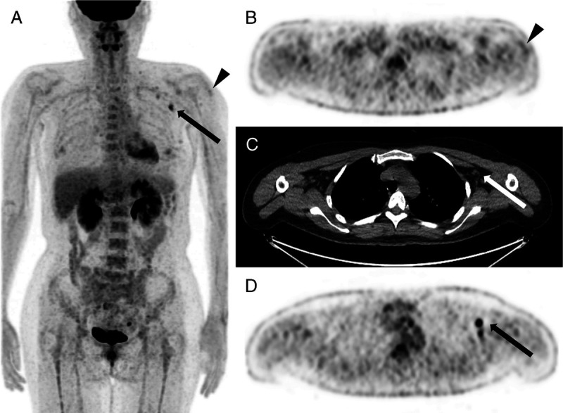 FIGURE 3