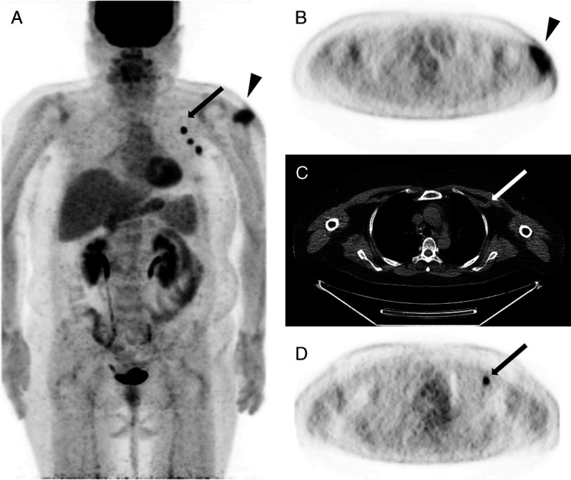 FIGURE 1