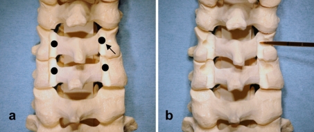 Fig. 1