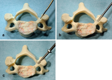 Fig. 3