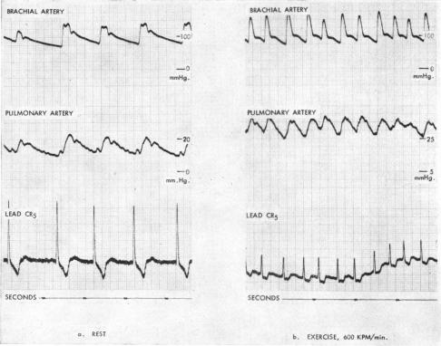 graphic file with name brheartj00328-0064-a.jpg