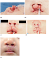 FIGURE 3