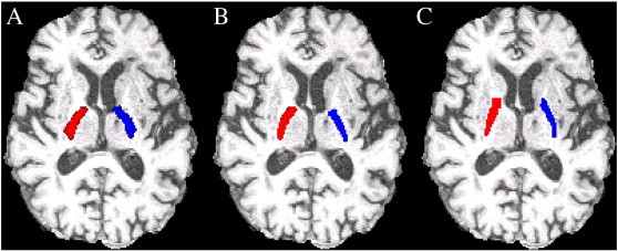 Fig. 2