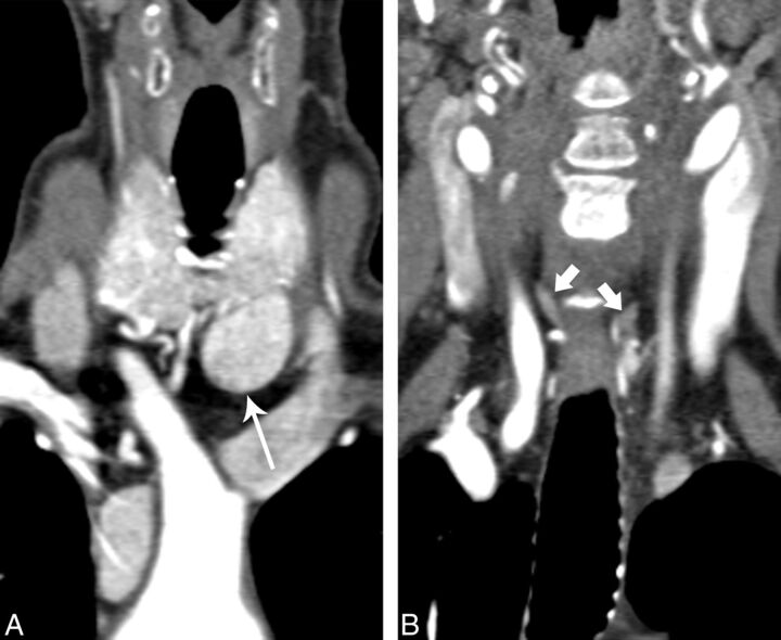 Fig 3.