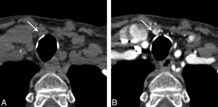 Fig 2.