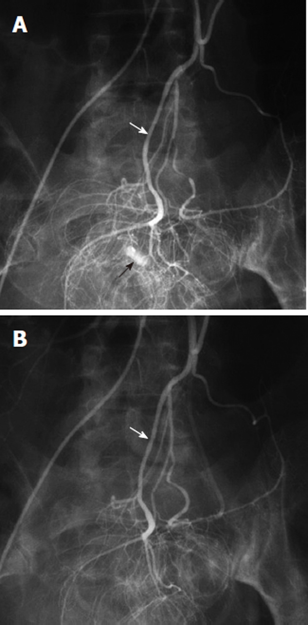 Figure 14