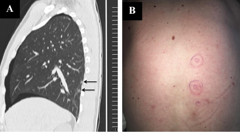 Fig. 5