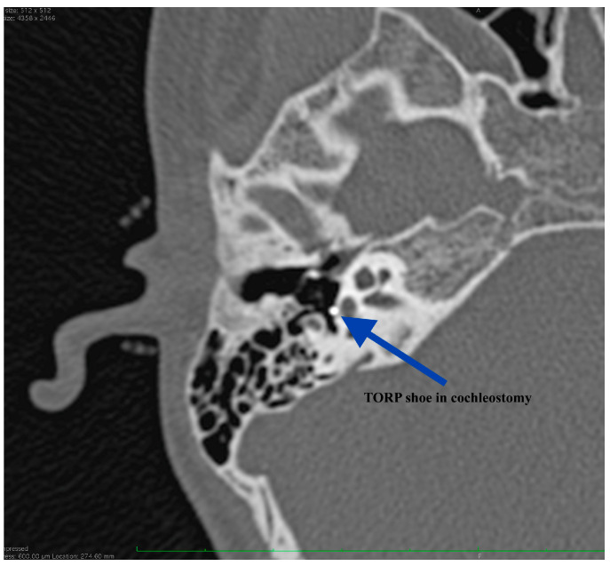 Figure 11