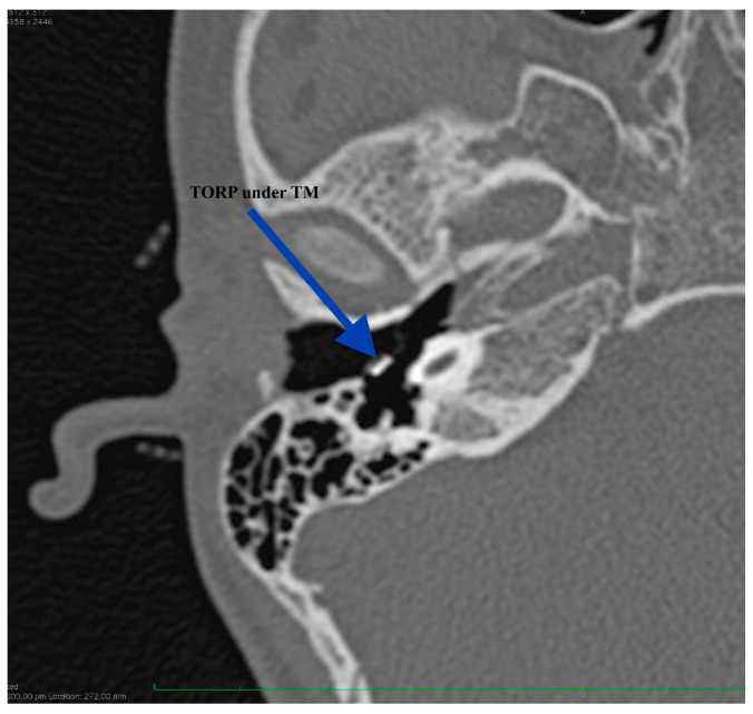 Figure 10