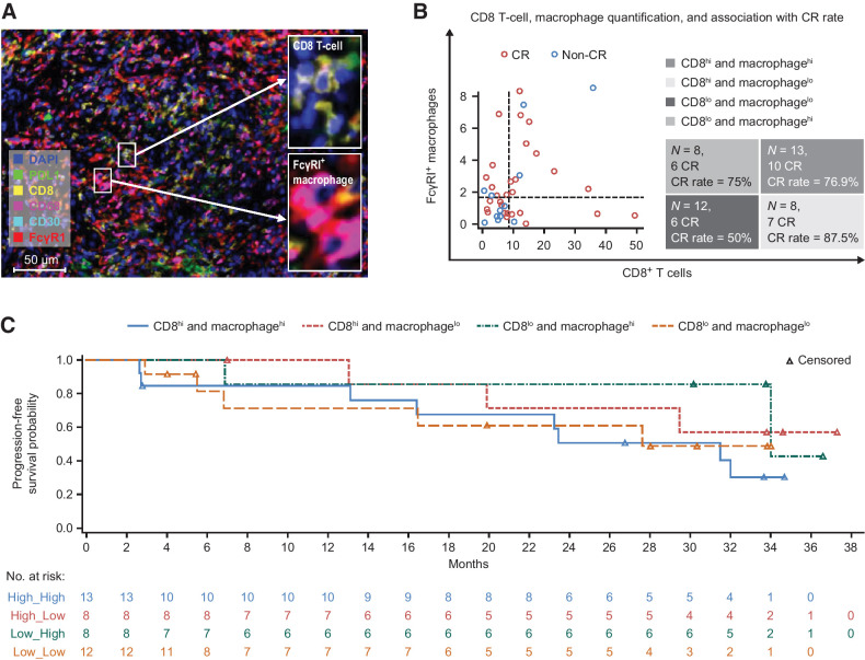 Figure 4. Associations of FcγRI+ macrophages in cHL tumor microenvironment with clinical outcomes of tislelizumab. A, Representative figure showing multiplex immunofluorescence staining (20× resolution) for CD8 T cells (CD8+ cells), total Fcγ receptor I (FcγRI+ cells), macrophages (CD68+ cells), FcγRI+ macrophages (FcγRI; CD68 double-positive cells), PDL1+, and CD30+ cells. B, CD8+ T cells, FcγRΙ+ macrophage infiltration, and their associations with complete response rates to tislelizumab. C, PFS by CD8+ T cells and FcγRΙ+ macrophages, divided by median cell percentage value of CD8 T cells and FcγRΙ+ macrophages separately. All mIHC images were acquired using Leica Aperio VERSA 8 auto-scanner. Note: (i) Make and model of microscope: LEICA DM6 B; (ii) Type, magnification, and numerical aperture of the objective lenses: ∞/0.17/OFM25/C, HC PL APO, 20×/0.80; (iii) Temperature: 20°C–30°C; (iv) Imaging medium: sCMOS: 23CAM014; (v) Fluorochromes: PerkinElmer Opal automation Multiplex IHC kit; (vi) Camera make and model: Andor Zyla 5.5; (vii) Acquisition software: Aperio VERSA. CR, complete response.