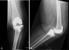 Fig. 6A–B