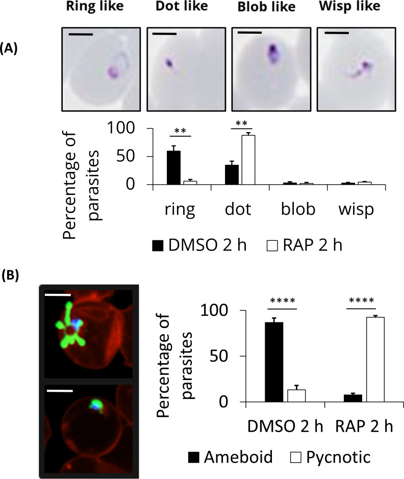 Micrographs show ring, dot, blob, and wisp forms of parasites under DMSO and RAP, as well as fluorescent-stained parasites showing ameboid or pycnotic structures. Bar graph compares the percentage of each form under DMSO and RAP treatments after 2 hours.