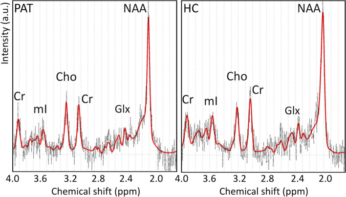 Fig. 3