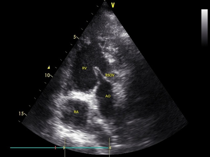 Figure 3