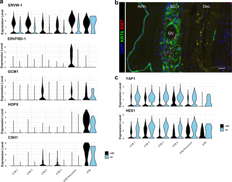 Figure 3—figure supplement 1.