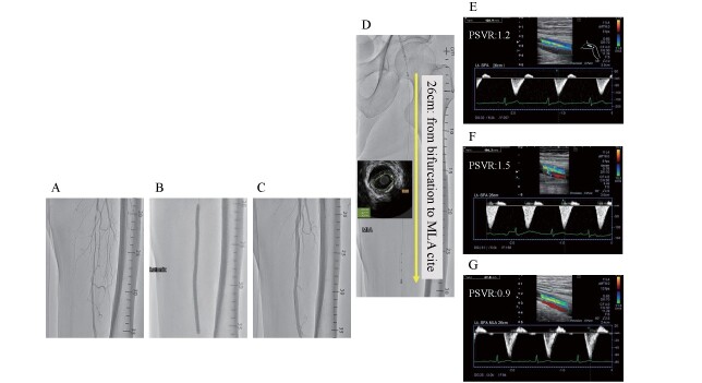 Fig.3. Representative case