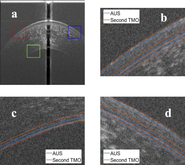 Figure 14