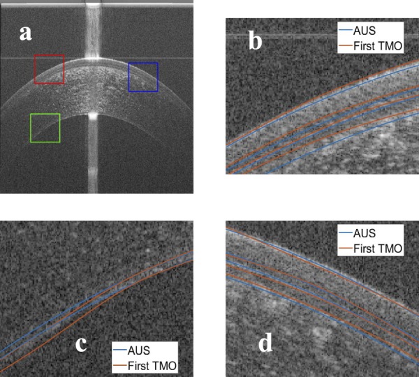 Figure 12