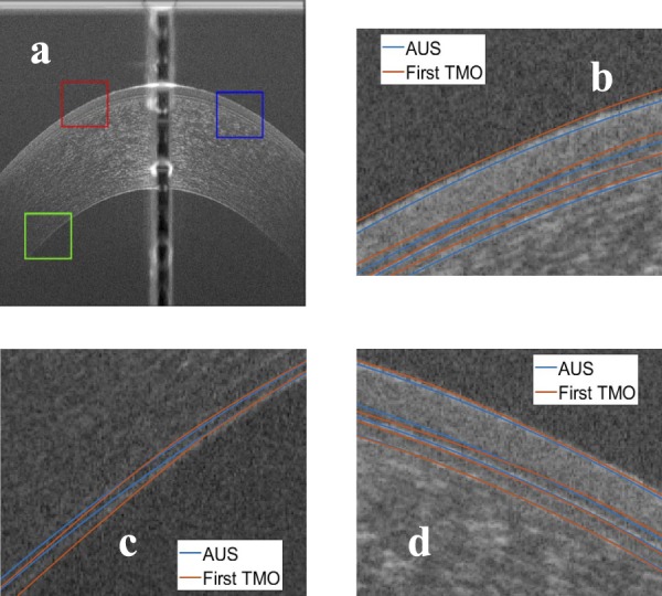 Figure 13