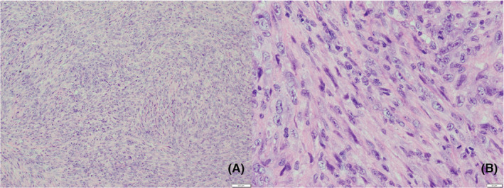 FIGURE 3