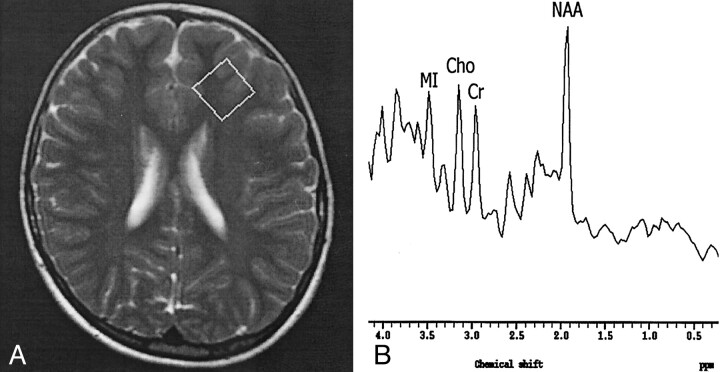 Fig 1.