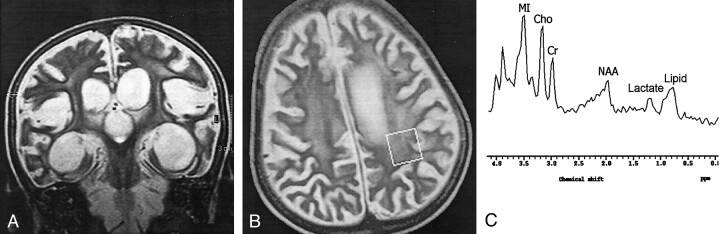 Fig 3.