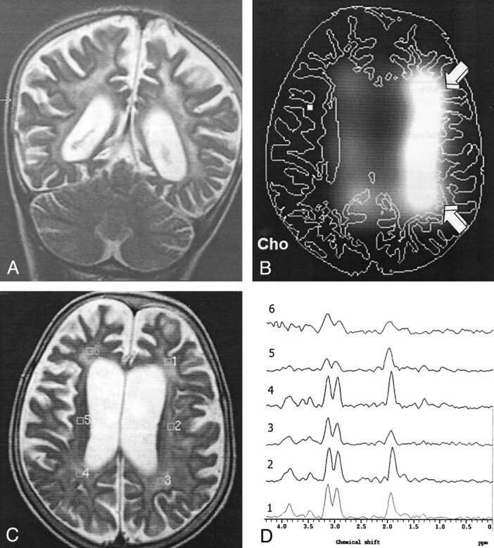 Fig 5.