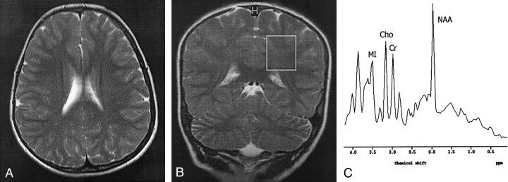 Fig 2.