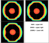 Fig. 12