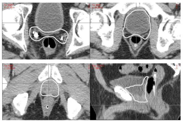 Figure 3a